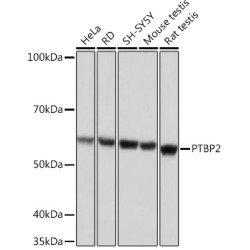 PTBP2 Rabbit mAb