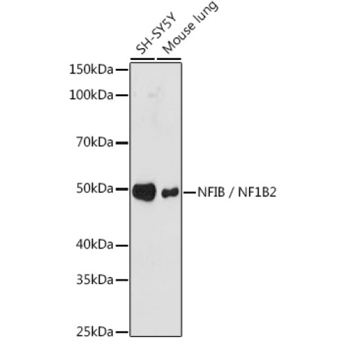 NFIB / NF1B2 Rabbit mAb