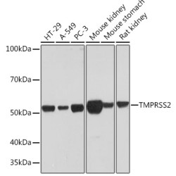 TMPRSS2 Rabbit mAb