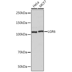 LGR6 Rabbit mAb