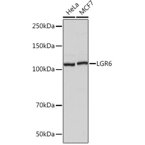 LGR6 Rabbit mAb