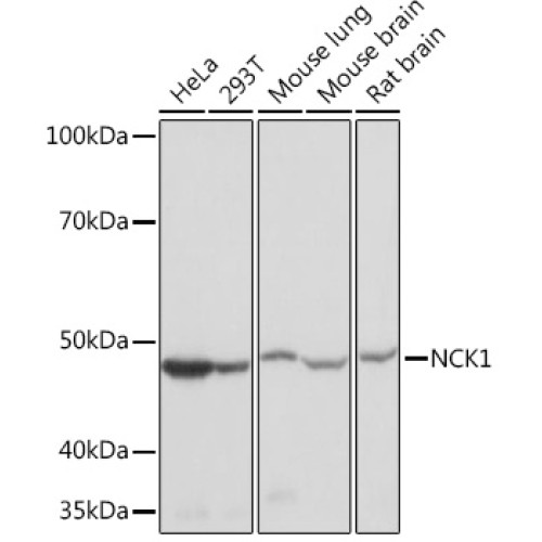 NCK1 Rabbit mAb