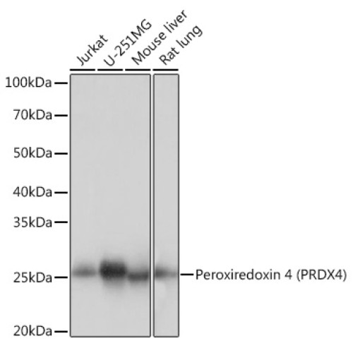 Peroxiredoxin 4 (PRDX4) Rabbit mAb