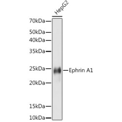 Ephrin A1 Rabbit mAb