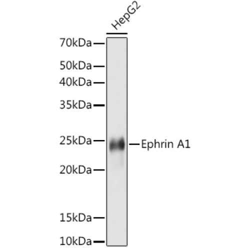 Ephrin A1 Rabbit mAb