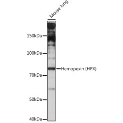 Hemopexin (HPX) Rabbit mAb