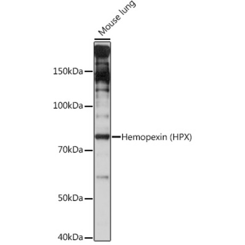 Hemopexin (HPX) Rabbit mAb