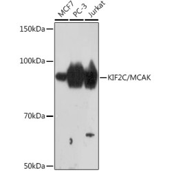KIF2C/MCAK Rabbit mAb