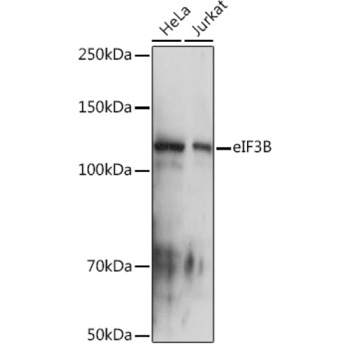 eIF3B Rabbit mAb