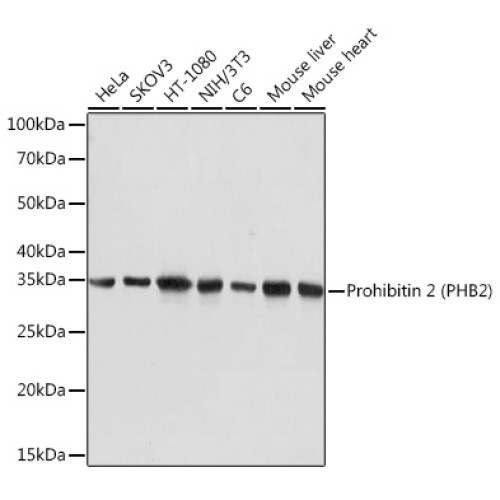 Prohibitin 2 (PHB2) Rabbit mAb
