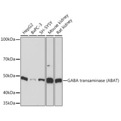 GABA transaminase (ABAT) Rabbit mAb