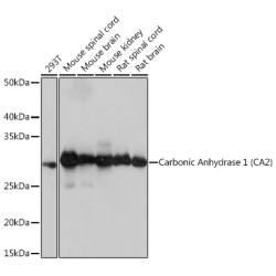 Carbonic Anhydrase 2 (CA2) Rabbit mAb