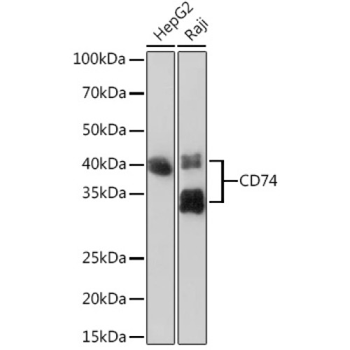 CD74 Rabbit mAb
