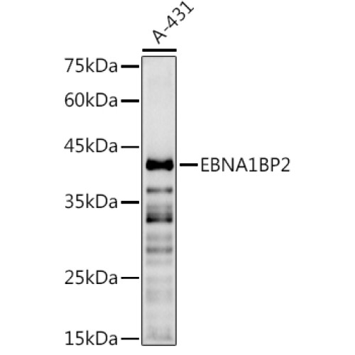EBNA1BP2 Rabbit pAb
