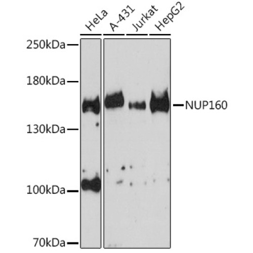 NUP160 Rabbit pAb