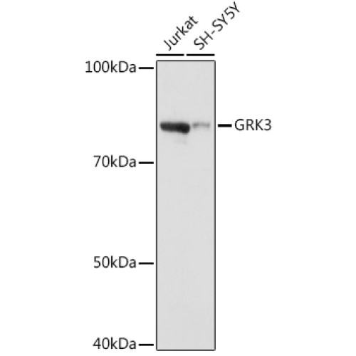 GRK3 Rabbit mAb
