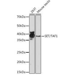 SET/TAF1 Rabbit mAb
