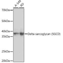 Delta-sarcoglycan (SGCD) Rabbit mAb