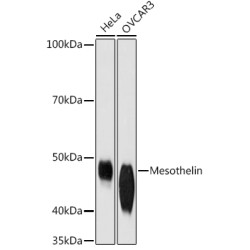 Mesothelin Rabbit mAb