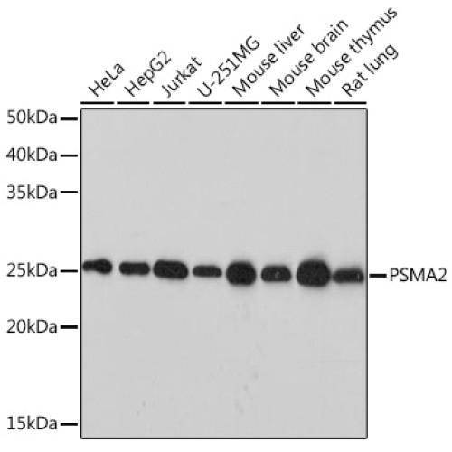 PSMA2 Rabbit mAb