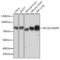 SR-B2/LIMPII Rabbit mAb