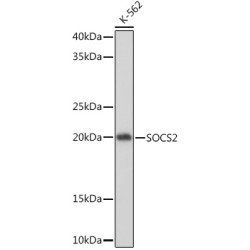 SOCS2 Rabbit mAb