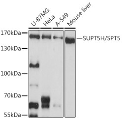 SUPT5H/SPT5 Rabbit pAb