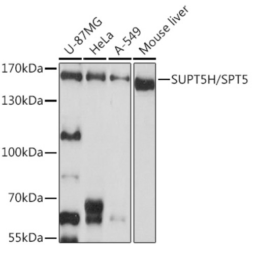 SUPT5H/SPT5 Rabbit pAb