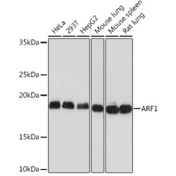 ARF1 Rabbit mAb