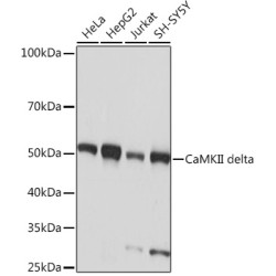 CaMKII delta Rabbit mAb