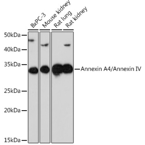 Annexin A4/Annexin IV Rabbit mAb