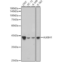 ALKBH1 Rabbit mAb