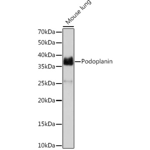 Podoplanin Rabbit mAb