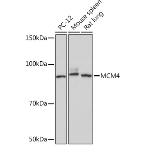MCM4 Rabbit mAb