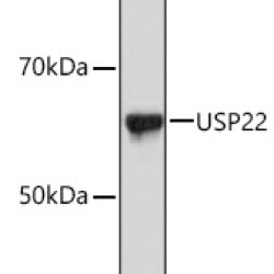 USP22 Rabbit mAb