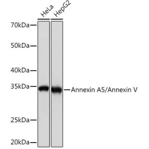 Annexin A5/Annexin V Rabbit mAb