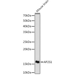AP2S1 Rabbit mAb