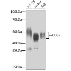 CD82 Rabbit mAb