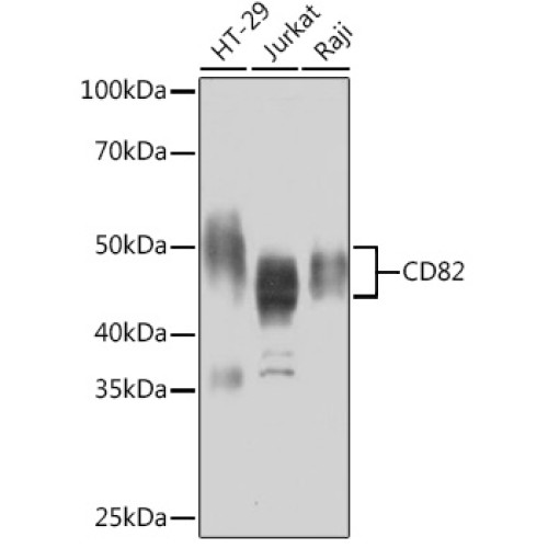 CD82 Rabbit mAb