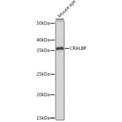 CRALBP Rabbit mAb