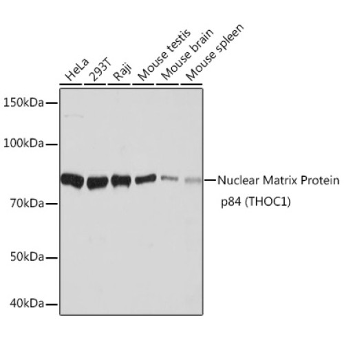Nuclear Matrix Protein p84 (THOC1) Rabbit mAb
