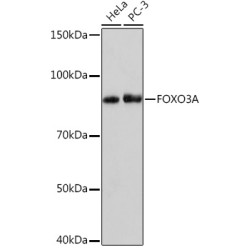 FOXO3A Rabbit mAb