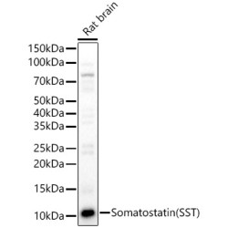 Somatostatin (SST) Rabbit pAb
