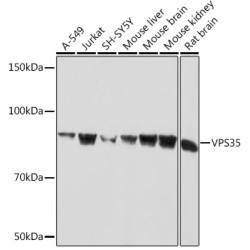 VPS35 Rabbit mAb