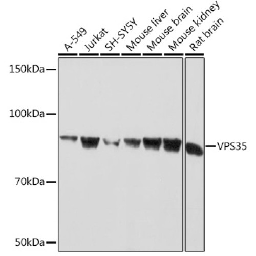 VPS35 Rabbit mAb