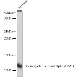 Hemoglobin subunit alpha (HBA1) Rabbit mAb