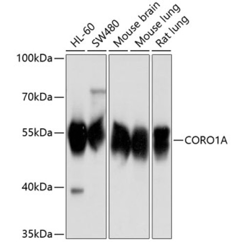 CORO1A Rabbit pAb