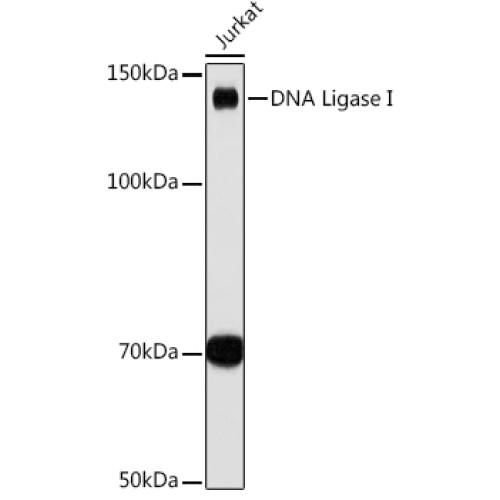 DNA Ligase I Rabbit mAb