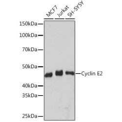 Cyclin E2 Rabbit mAb