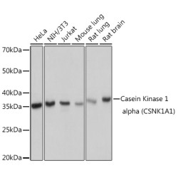 Casein Kinase 1 alpha (CSNK1A1) Rabbit mAb